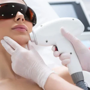 DIODE LASER FACE